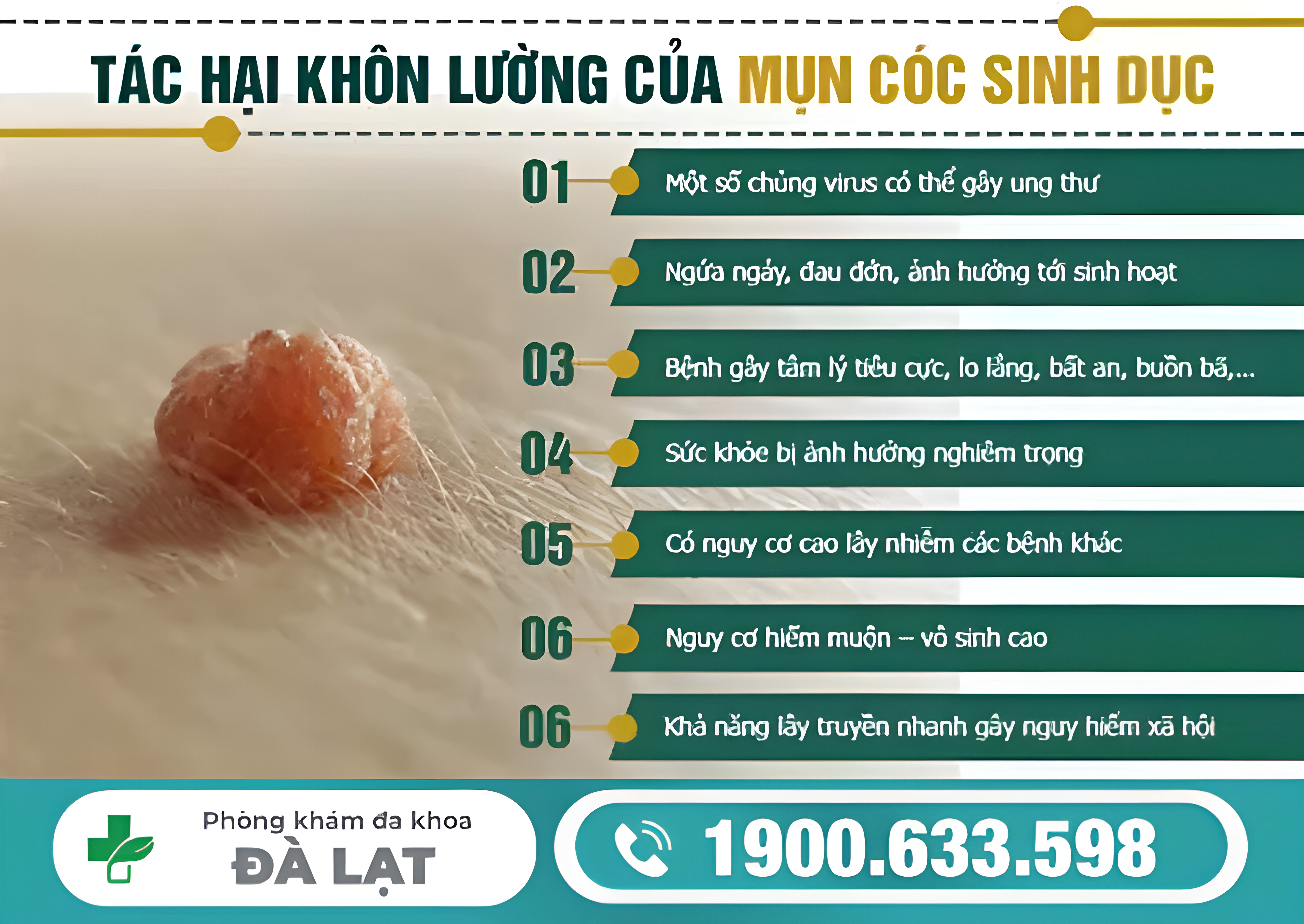 Hình ảnh minh họa